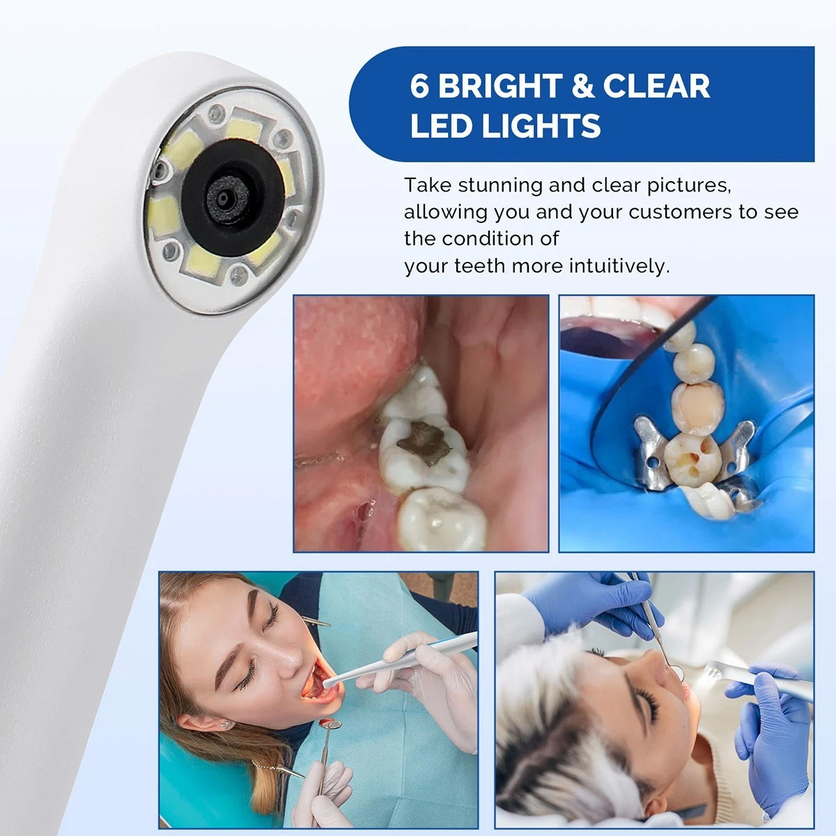 Magenta MD280 720P HD USB Dental Intraoral Camera for Win 10/11